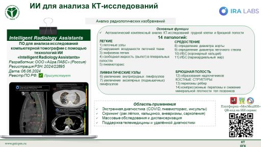 ПО для анализа исследований компьютерной томографии с помощью технологий ИИ «Intelligent Radiology Assistants