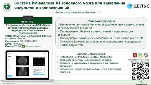 Программное обеспечение ЦЕЛЬС® для автоматического анализа цифровых медицинских КТ-изображений головного мозга