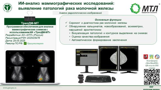 Программное обеспечение для анализа маммографических снимков с использованием ИИ «ТриоДМ-МТ»