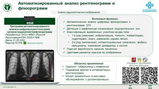 Программа автоматизированного анализа цифровых рентгенограмм органов грудной клетки/флюорограмм