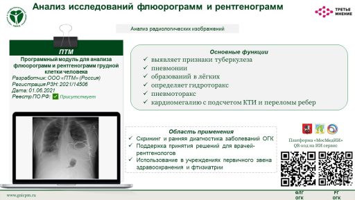 Программный модуль для анализа флюорограмм и рентгенограмм грудной клетки человека