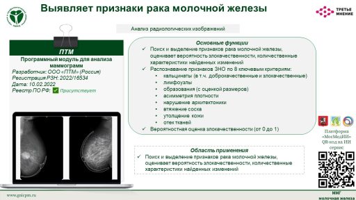 Программный модуль для анализа маммограмм