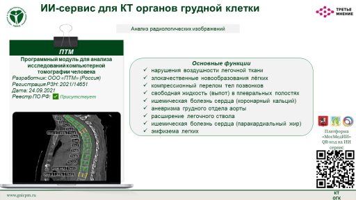 Программный модуль для анализа исследований компьютерной томографии человека