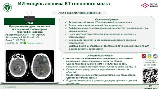Программный модуль для анализа исследований компьютерной томографии человека