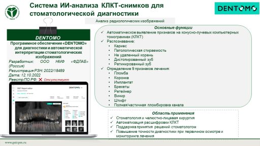 Программное обеспечение «DENTOMO» для диагностики и автоматической интерпретации стоматологических изображений