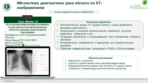 ПО «Система нейросетевая Care Mentor AI для диагностики признаков рака легкого по данным компьютерной томографии»