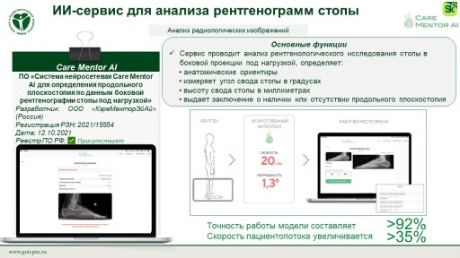 ПО «Система нейросетевая Care Mentor AI для определения продольного плоскостопия по данным боковой рентгенографии стопы под нагрузкой»