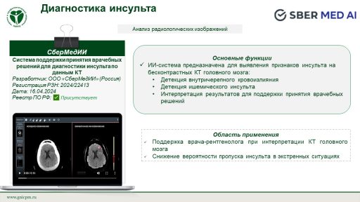 Система поддержки принятия врачебных решений для диагностики инсульта по данным КТ