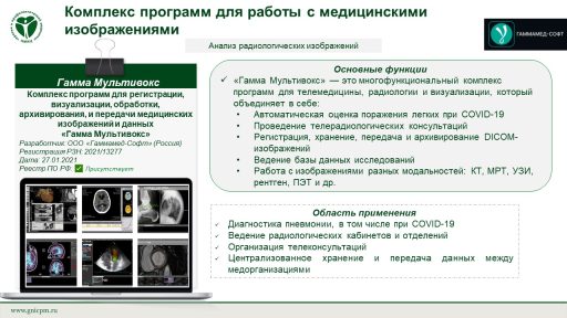Комплекс программ для регистрации, визуализации, обработки, архивирования, и передачи медицинских изображений и данных  «Гамма Мультивокс»