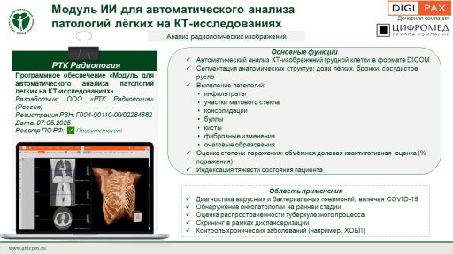 Программное обеспечение «Модуль для автоматического анализа патологий легких на КТ-исследованиях»