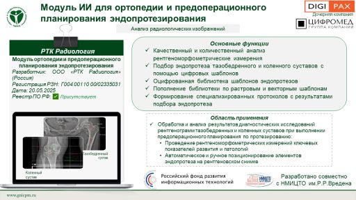 Модуль ортопедии и предоперационного планирования эндопротезирования