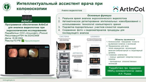 Программное обеспечение ArtInCol для анализа видеопотока при эндоскопических исследованиях