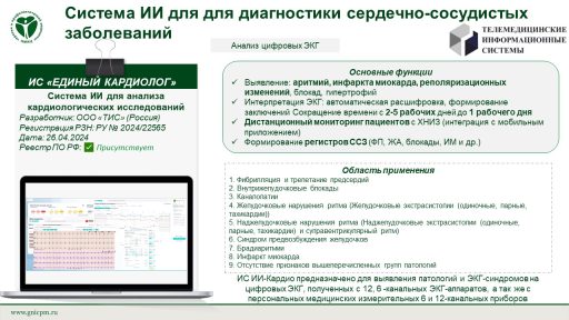 Система ИИ для анализа кардиологических исследований