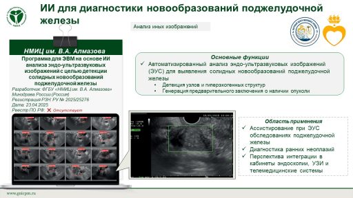 Программа для ЭВМ на основе ИИ анализа эндо-ультразвуковых изображений с целью детекции солидных новообразований поджелудочной железы