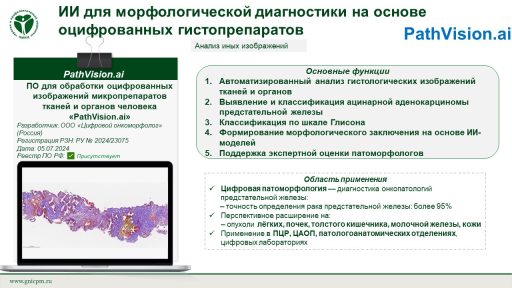 ПО для обработки оцифрованных изображений микропрепаратов  тканей и органов человека «PathVision.ai»