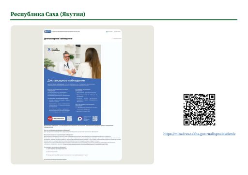 Республика Саха (Якутия). Информация о диспансерном наблюдении на сайте РОИВ